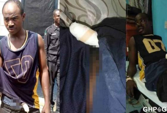 Armed robber whose manhood was bitten by a lady he raped finally speaks.