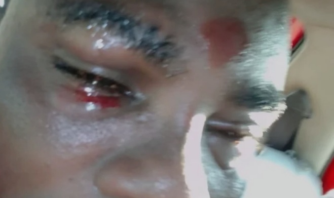 Parliamentary Contest Turns Bloody in Fomena Constituency